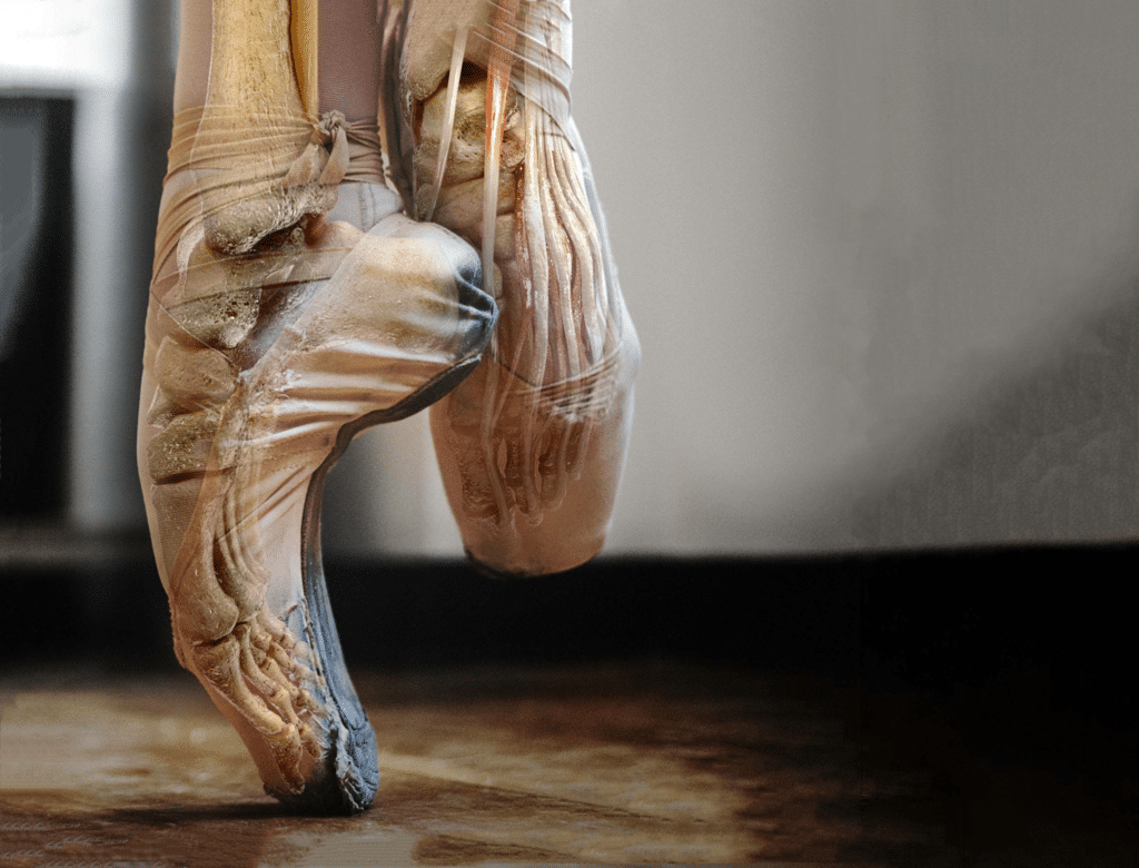 Common Pointe Shoe Problems & Solutions - Step by Step Dancewear